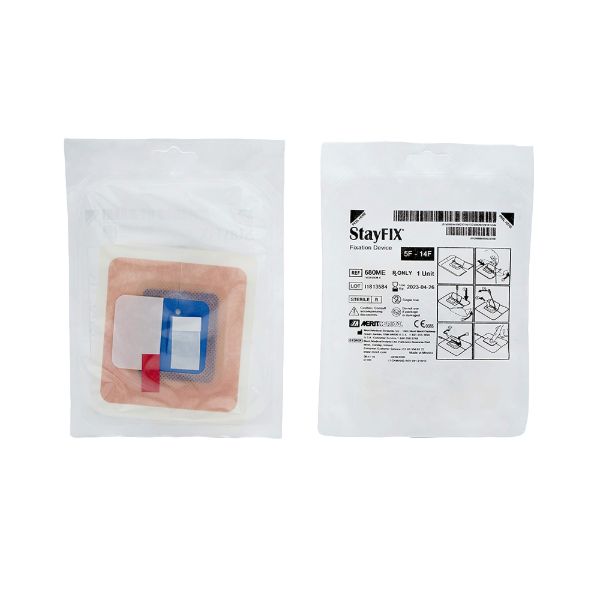 StayFIXFixationDevice_cd_MM680ME