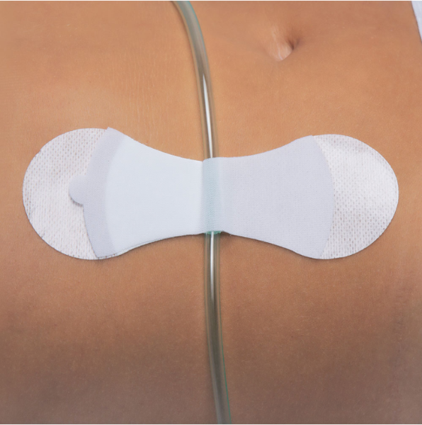 Grip-LokforLargeUniversalSecurement_pr_60715